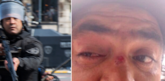 Disparar a los ojos: un militante perdió la visión luego de protestar por alimentos para comedores